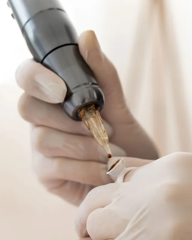 Dermógrafo em uso no curso de micropigmentação de aréolas em Brasília