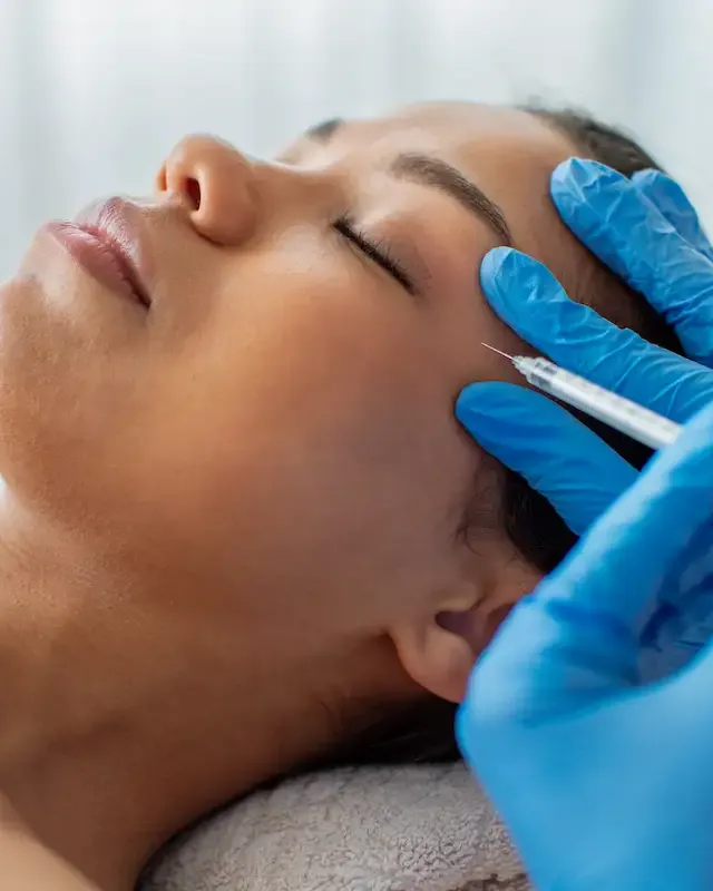 Aplicação de toxina botulínica (botox) na testa em clínica de Brasília